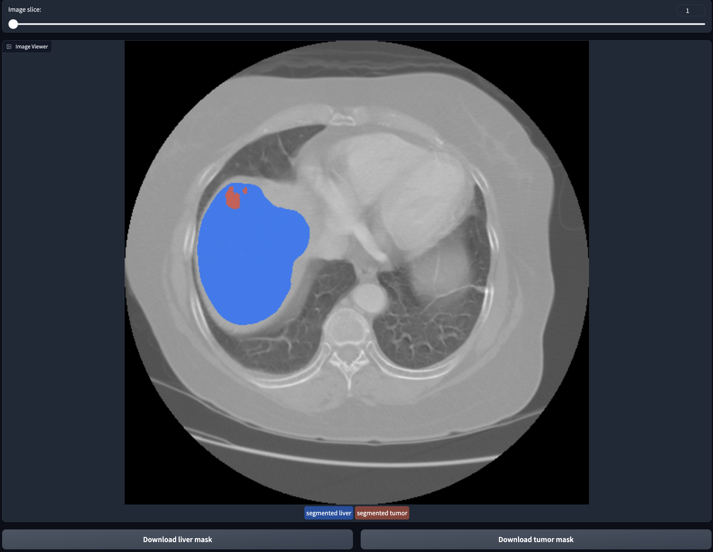 medassist-liver